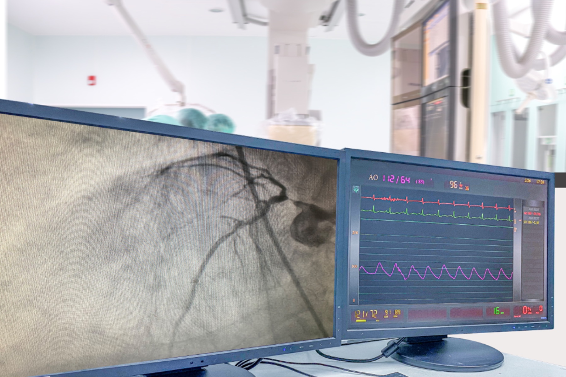 Monitores en sala de hemodinamia